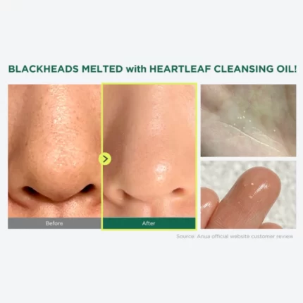 Heartleaf Pore Control Cleansing Oil Anua - Κορεάτικα Καλλυντικά