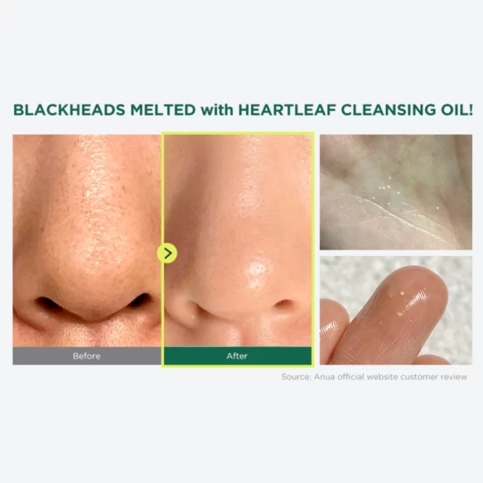 Heartleaf Pore Control Cleansing Oil Anua - Κορεάτικα Καλλυντικά