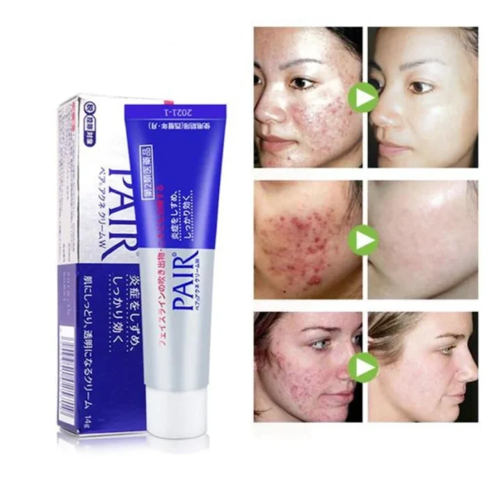 Pair Acne Cream W Lion - Ιαπωνικά Καλλυντικά