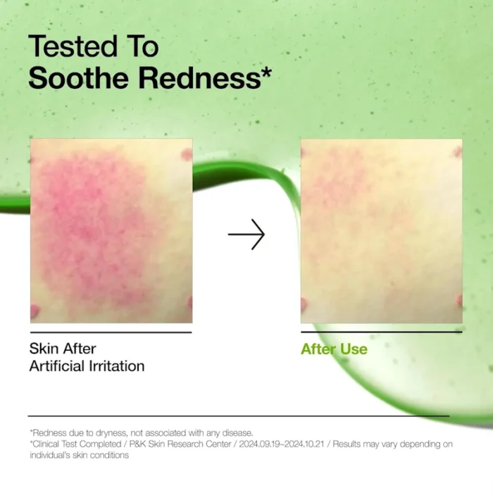 Azelaic Acid hyaluron redness serum anua - Κορεάτικα ΚΑλλυντικά