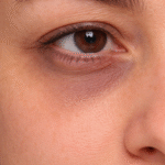 Μαύροι Κύκλοι