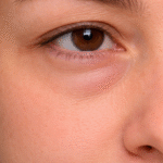 Σακούλες-Πρήξιμο